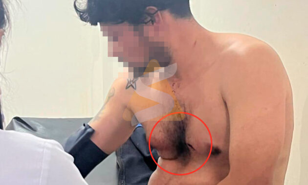 En medio de la ingesta de bebidas alcohólicas surgió una fuerte discusión y Araújo, supuestamente, tomó un machete y aplicó un corte en el pecho del joven, lado izquierdo, para luego darse a la fuga. Foto: Redacción Suceso.