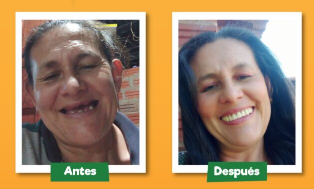 Con esfuerzo y apoyo mutuo, 25 mujeres finalistas del concurso “Mi Sonrisa Feliz” lograron recuperar su salud bucal, autoestima y esperanza, demostrando que una sonrisa puede ser el primer paso hacia una vida mejor