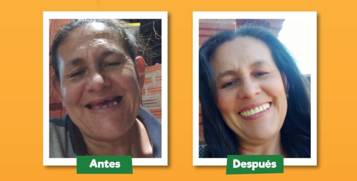 Con esfuerzo y apoyo mutuo, 25 mujeres finalistas del concurso “Mi Sonrisa Feliz” lograron recuperar su salud bucal, autoestima y esperanza, demostrando que una sonrisa puede ser el primer paso hacia una vida mejor