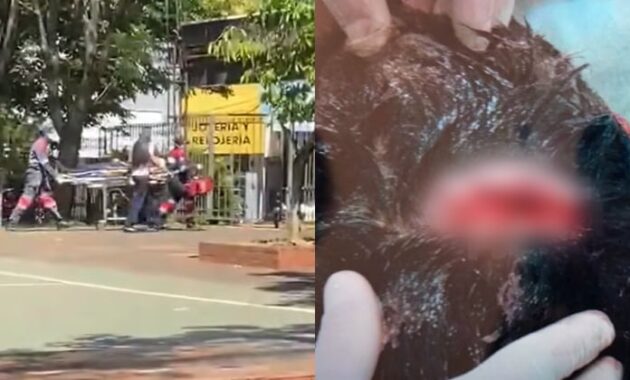 Uno de los estudiantes sufrió una herida a la altura de la cabeza. Foto: Gentileza.