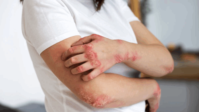 Consulta. Expertos recomiendan consultar para recibir tratamiento y disminuir los síntomas de la enfermedadFREEPIK Consulta. Expertos recomiendan consultar para recibir tratamiento y disminuir los síntomas de la enfermedadFREEPIK