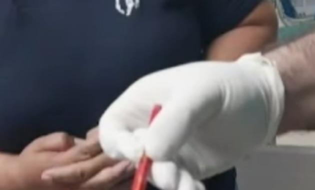 El lápiz se le incrustó en el glúteo, que le provocó una grave herida en el intestino y una hemorragia. Foto: Captura de pantalla