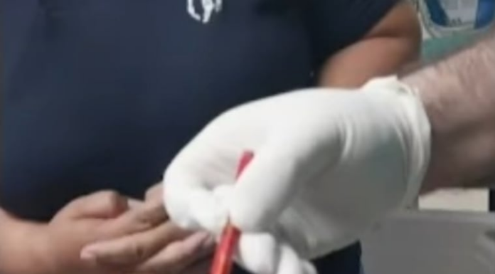 El lápiz se le incrustó en el glúteo, que le provocó una grave herida en el intestino y una hemorragia. Foto: Captura de pantalla