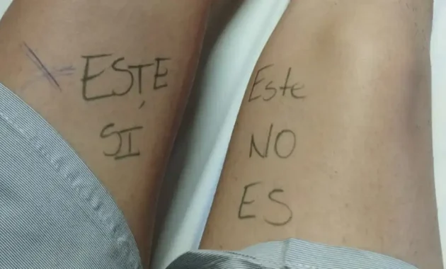 Creativa estrategia. Mariangel dejó bien en claro que pierna operar. Gentileza.